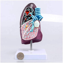 Human Lung Anatomical Model 2:3 Life Size Diseased Lung Anatomy Model for Medical Teaching and Classroom