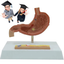 Life Size Human Stomach Anatomy Model with Base, Pathological Detail for Medical Education and Research Display