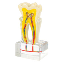 Dental Teaching Model Six Times Life Size with Removable Teeth for Student and Patient Education
