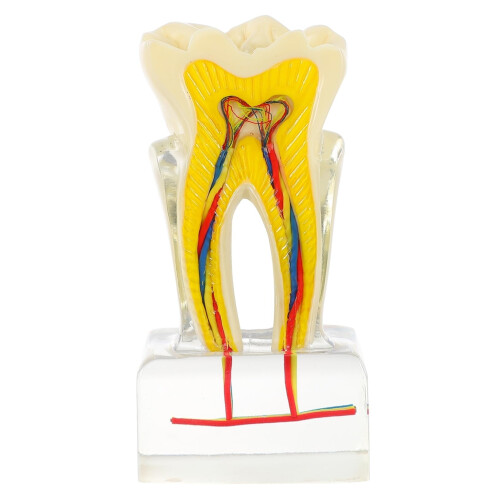 Dental Teaching Model 6X Enlarged Tooth Anatomy with Clear Structure for Student Study and Training
