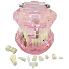 Dental Typodont Model M2001 Pink Gingiva for Implant Restoration, Bridge Practice and Oral Pathology Study