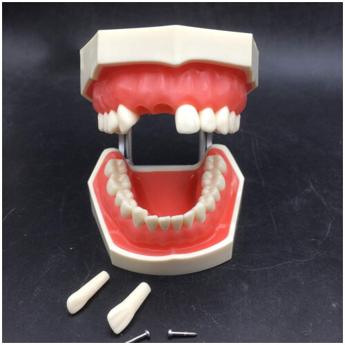 Dental Teeth Model with Gums for Teaching Study, Crown and Cavity Preparation Training 2