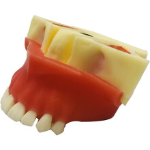 Dental Implant Training Model with Realistic 1:1 Anatomy, Resin Maxillary Sinus Lift Teaching Model