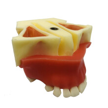 Dental Implant Training Model with Realistic 1:1 Anatomy and Maxillary Sinus Lift Simulation