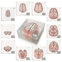 Glass Brain Specimen Coasters, Set of 10 Labelled Slices That Reassembles into Full Brain, for Anatomical Science Home Decor
