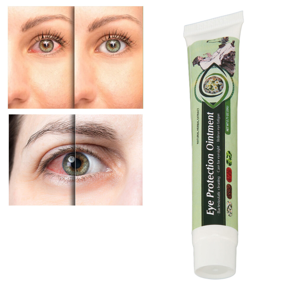 Cream Eye Protection Repair 20G - Relieve Strain & Prevent Myopia