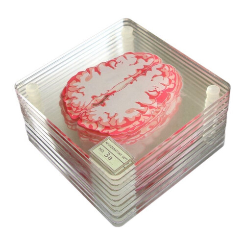 20X Brain Specimen Coasters Set 3D Organ Brain Artwork Brain Slices Square Acrylic Drinks Table Coaster 2
