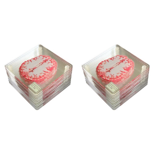 20X Brain Specimen Coasters Set 3D Organ Brain Artwork Brain Slices Square Acrylic Drinks Table Coaster 1