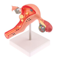 Female Uterine Model, Anatomy of Reproductive Organ Structure, Human Teaching Pathology, Ovarian Hospital, School Use