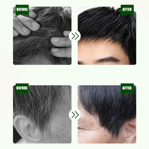 Chestnut Brown Permanent Hair Dye with Botanical Essential Oils for LongLasting Gray Coverage 2