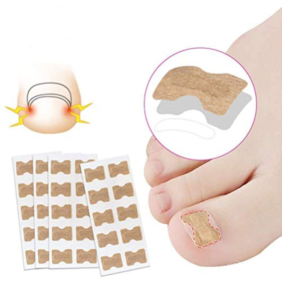 50PCS Ingrown Toenail Correction Patch Waterproof Breathable Elastic Cotton Toenail Brace Strips