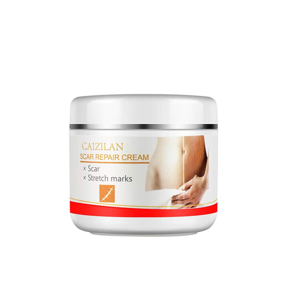 Cream Scar Removal For Acne Marks And Stretch Marks Multiscar Reduction Treatment