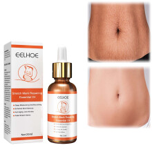 Stretch Mark Removal Oil 20ml Scar Reduction and Elasticity Support for Pregnancy and Postpartum