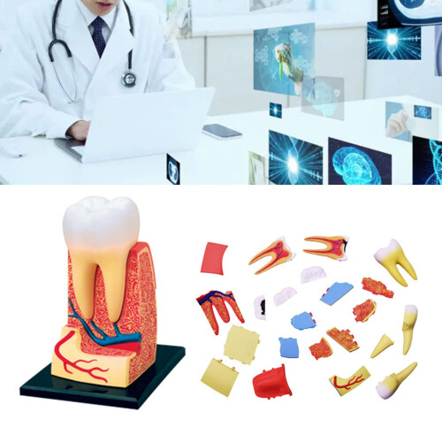 Tooth Anatomy Model with Removable Structure and CrossSection View for Dental Teaching and Study 1