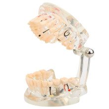 Dental Implant Study Model with Accurate Adult Teeth Anatomy for Pathology and Training Use
