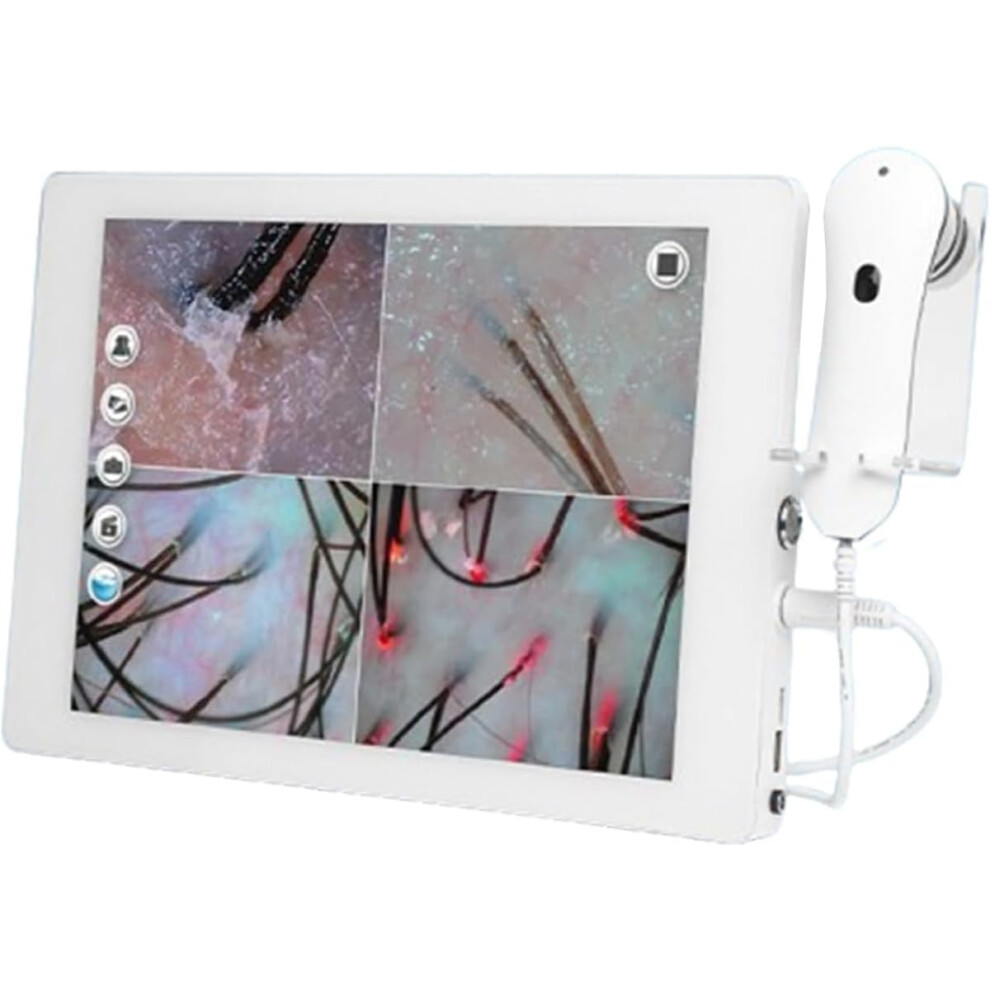 Skin and Scalp Analyzer with HD Touch Screen, 70X 200X Lenses, TripleSpectrum Lighting for Salon