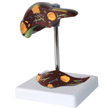 LifeSize Human Liver Anatomy Model with Gallbladder, ColorCoded PVC for Medical Education