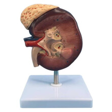 Human Kidney Anatomical Model 2x Magnified with Clear Digital Labels for Medical Education