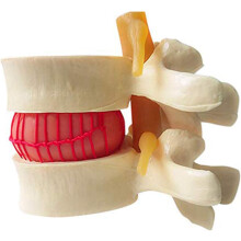 Lumbar Spine Model with Flexible Disc Simulation, 1:1.5 Scale Vertebra Anatomy Teaching Aid