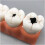 Dental Pathology Model with Removable Teeth and Deep Decay Visualization for Teaching and Demonstration 4