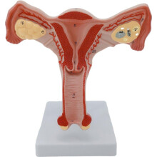 Anatomical Uterus Model with Clear Detail PVC Female Reproductive System for Medical Teaching
