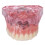 Dental Implant Model for Overdenture Training with Clear Visual Demonstration and Patient Education Tool 1