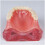 Dental Implant Model for Overdenture Training with Clear Visual Demonstration and Patient Education Tool 2