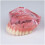 Dental Implant Model for Overdenture Training with Clear Visual Demonstration and Patient Education Tool 3