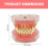 Dental Typodont Model with Realistic Removable Teeth for Student Practice and Hygiene Training 2