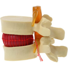 Lumbar Spine Anatomy Model with Enlarged Vertebrae and Nerve for Medical Training and Teaching
