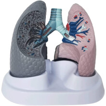 Lung Anatomy Model with Healthy vs Diseased Comparison, Handpainted PVC for Medical Teaching