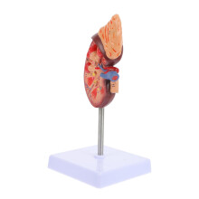 Anatomical Kidney Model with Base, Life Size Detachable Human Kidney Anatomy for Classroom Teaching