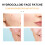 Hydrocolloid Acne Pimple Patch Set for Face, 5PCS, Transparent 15
