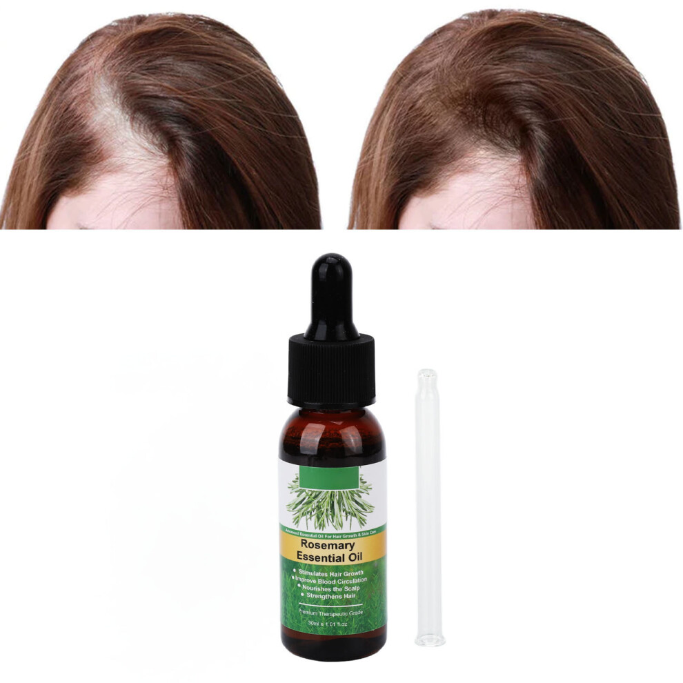 Rosemary Hair Oil Essential 30ml Nourishing Strengthening Hair Growth Treatment