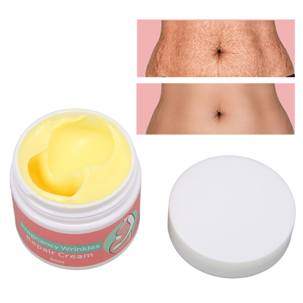 Cream 50Ml Scar & Stretch Mark Remover For Pregnancy, Wrinkles, & Moisturizing