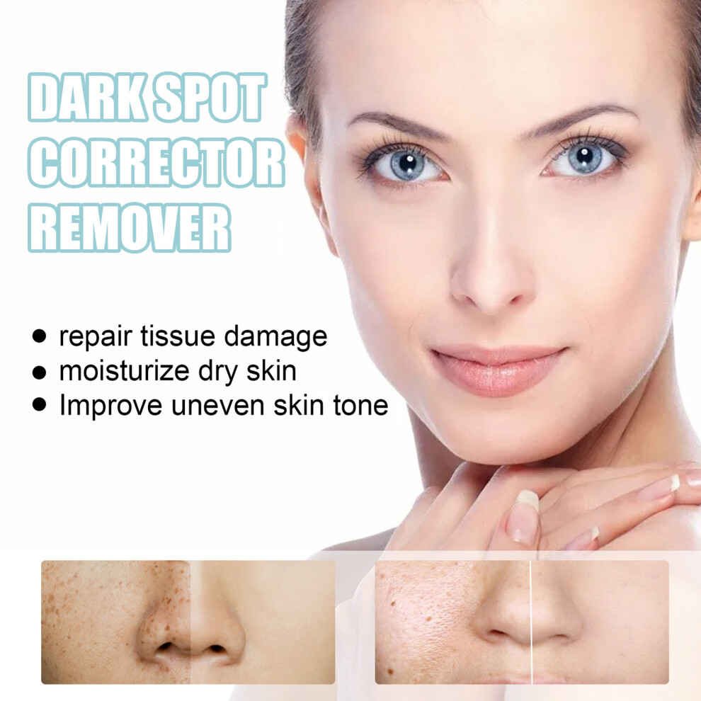 Dark/Cream Eelhoe 30G Spot Corrector Whitening Moisturizer For Skin Repair