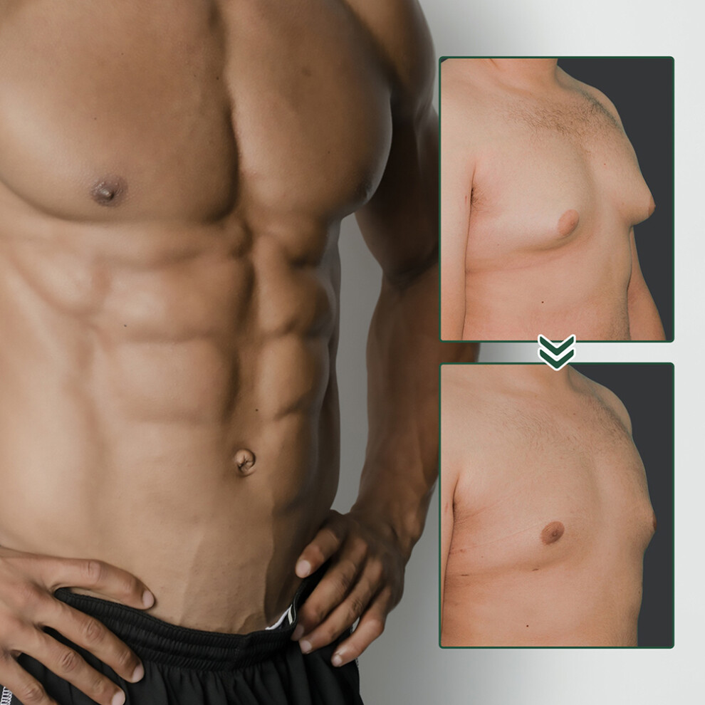 Cream Ginger Gynecomastia Tightening 30Ml Cellulite Firming Lotion