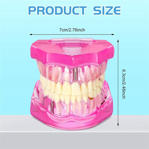 Disease Teeth Model Dental Typodonts Implant Teeth Model with Removable Teeth Pathological Demonstration (,2 Pcs) 1
