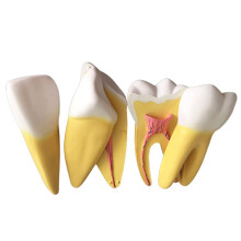 Dental Teaching Model 12x Enlarged with Removable Teeth Transparent Tooth Anatomy for Training
