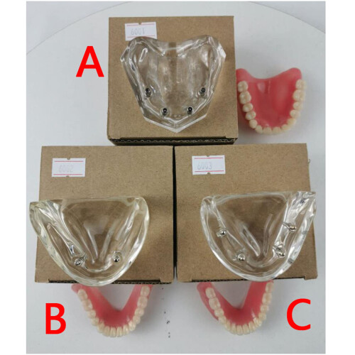 Dental Implant Model with Clear Visualization and Realistic Tooth Anatomy for Teaching and Study 2