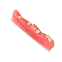 Lifesize Wisdom Tooth Extraction Model for Realistic Dental Training and Impacted Tooth Practice