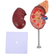 Human Kidney Anatomy Model LifeSize with Detachable Design and Stand for Classroom Education