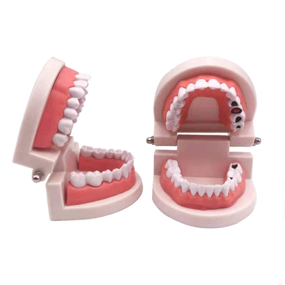 Dental Teaching Model Set with Decayed Teeth for Kids Oral Hygiene and Tooth Brushing Training