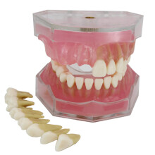 Dental Implant Typodont with Realistic Oral Pathology, Removable Teeth, Lifesize Anatomy for Study