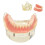 Dental Teaching Model Lower Jaw Overdenture with 4 Implants for Hygiene Training and Demonstration 1