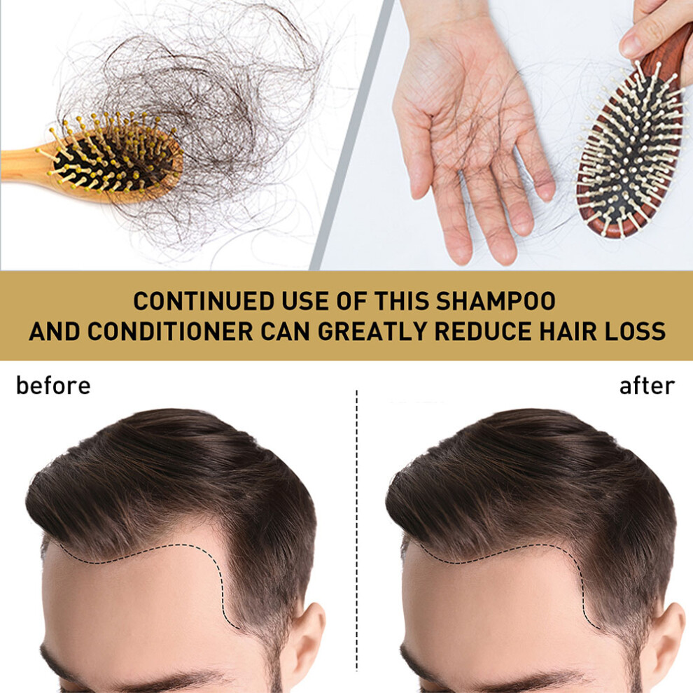 100ml Ginger Shampoo for Hair Growth, Anti Hair Loss & Dandruff Relief