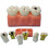 Dental Caries Model with Clear Caries Progression View for Patient Education and Classroom Training 1
