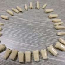 Replacement Typodont Teeth with Realistic Occlusal Anatomy for Dental Students and Preclinical Training