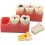 Dental Caries Model with Clear Caries Progression View for Patient Education and Classroom Training 4