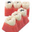 Dental Caries Model with Clear Caries Progression View for Patient Education and Classroom Training 5